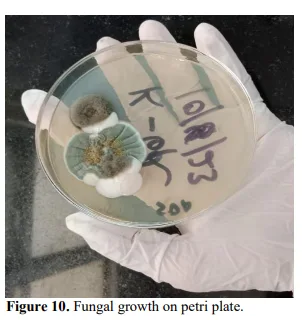 Epidemiology and Mycological Analysis of Superficial Mycosis in a Northern Indian Tertiary Care Hospital 11 figures