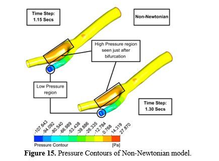 Revealing the Hemodynamic Orchestra: Contrasting Analysis of Blood Flow Patterns in a Bifurcated Carotid Artery 16 figures