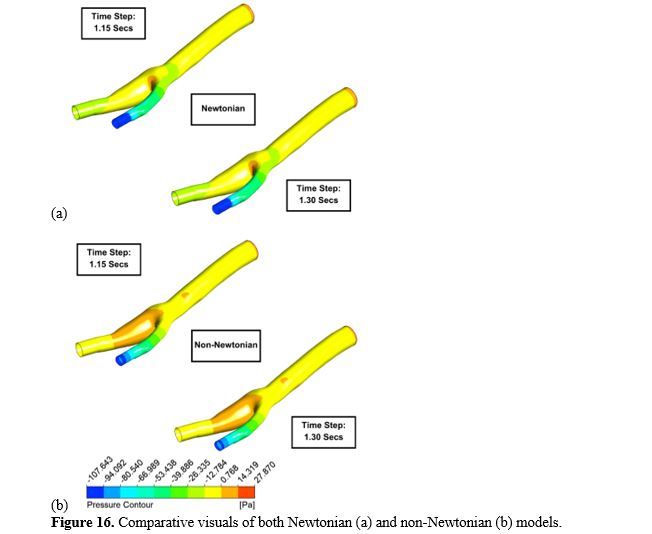 Revealing the Hemodynamic Orchestra: Contrasting Analysis of Blood Flow Patterns in a Bifurcated Carotid Artery 17 figures