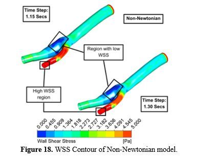 Revealing the Hemodynamic Orchestra: Contrasting Analysis of Blood Flow Patterns in a Bifurcated Carotid Artery 19 figures