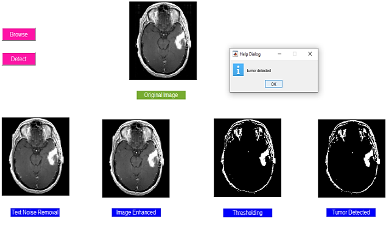 a29ae7a7 study on brain